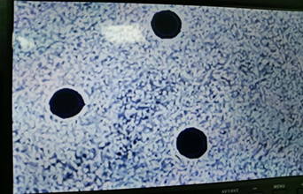 富泰鑫：突破極限的精細制造微孔加工廠家